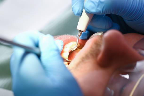 Best Emergency Dental Services for Seniors in Gunbarrel, CO
