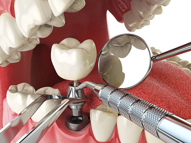 Best Mobile Emergency Dentist in Gunbarrel, CO